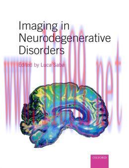 [AME]Imaging in Neurodegenerative Disorders