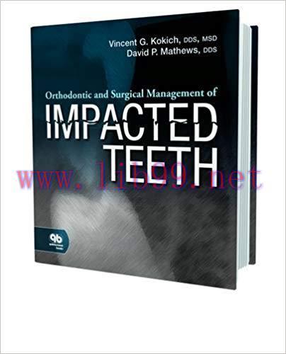 [PDF]Orthodontic and Surgical Management of Impacted Teeth