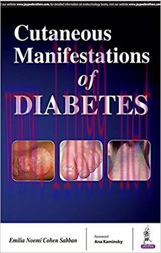 [PDF]Cutaneous Manifestations of Diabetes
