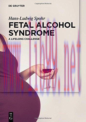 [AME]Fetal Alcohol Syndrome (EPUB)