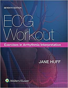 (PDF)ECG Workout Exercises in Arrhythmia Interpretation