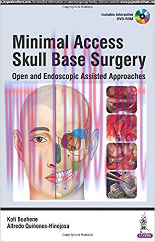 [PDF]Minimal Access Skull Base Surgery - Open and Endoscopic Assisted Approaches