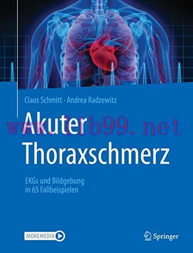 [AME]Akuter Thoraxschmerz: EKGs und Bildgebung in 65 Fallbeispielen (German Edition) (Original ...