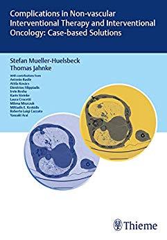 Complications in Non-vascular lnterventional Therapy and lnterventional Oncology Cased-based So...