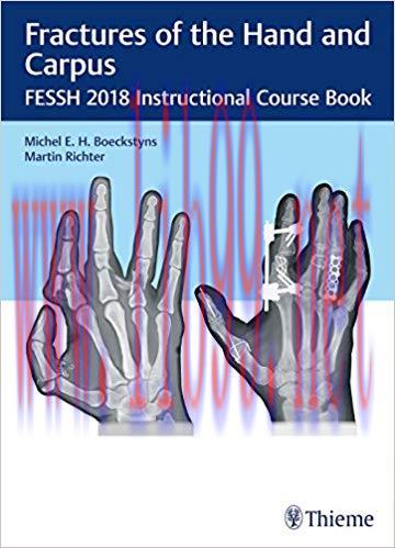 [PDF]Fractures of the Hand and Carpus