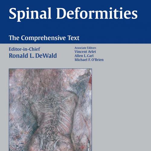Spinal Deformities_ The Comprehensive Text 1th - Dewald, Ronald L_