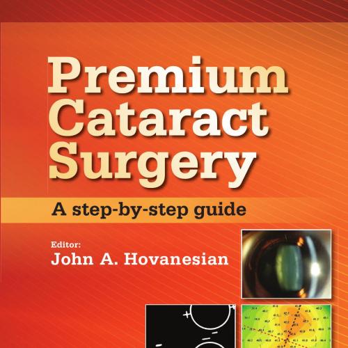 Premium Cataract Surgery_ A Step-by-Step Guide