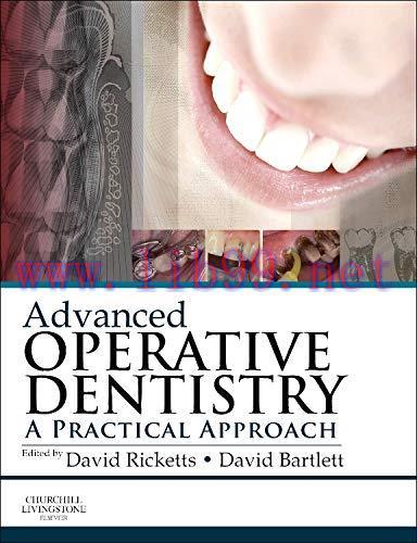 [AME]Advanced Operative Dentistry: A Practical Approach (Original PDF)