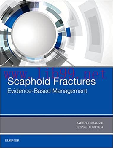 (PDF)Scaphoid Fractures: Evidence-Based Management 1st Edition