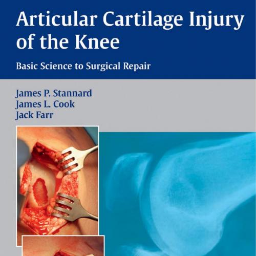 Articular Cartilage Injury of the Knee Basic Science to Surgical Repair