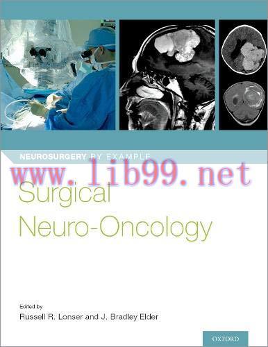 [AME]Surgical Neuro-Oncology (Neurosurgery by Example) (PDF)