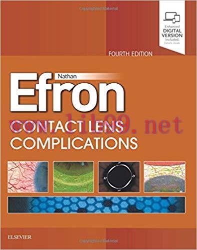 [PDF]Contact Lens Complications 4th Edition (ξlsev|eγ)
