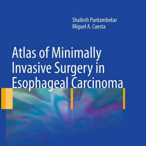 Atlas of Minimally Invasive Surgery in Esophageal Carcinoma