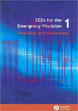 [AME]ECG’s for the Emergency Physician 1