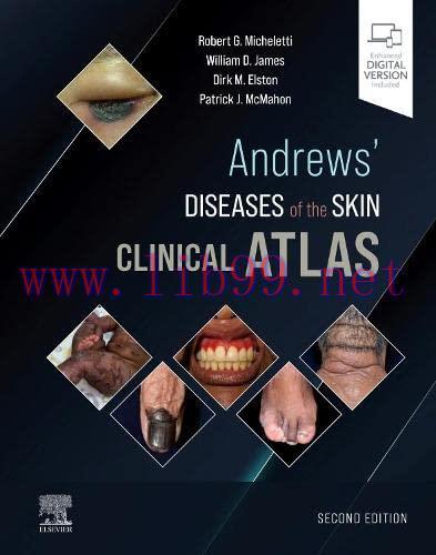 [AME]Andrews&rsquo; Diseases of the Skin Clinical Atlas, 2nd Edition (Original PDF)