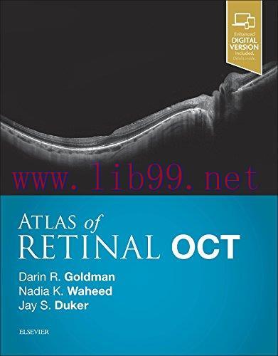 [AME]Atlas of Retinal OCT: Optical Coherence Tomography, 1e (PDF)
