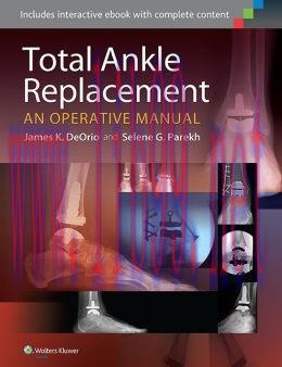[AME]Total Ankle Replacement: An Operative Manual (ORIGINAL PDF from_ Publisher)