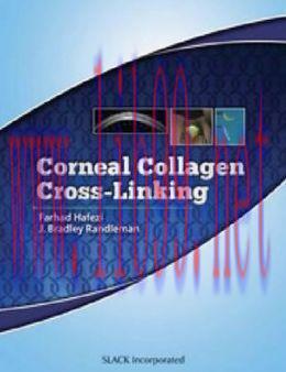 [AME]Corneal Collagen Cross Linking (ORIGINAL PDF from_ Publisher)