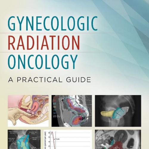 Gynecologic Radiation Oncology_ A Practical Guide