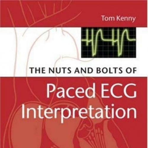 Nuts and bolts of Paced ECG Interpretation (Nuts and Bolts Series), The - Wei Zhi