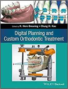 Digital Planning and Custom Orthodontic Treatment