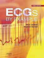[AME]ECGs by Example, 3rd Edition (Original PDF)