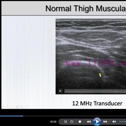 [Media]Fundamentals of Musculoskeletal Ultrasound (Fundamentals of Radiology) 3rd Edition_Video...