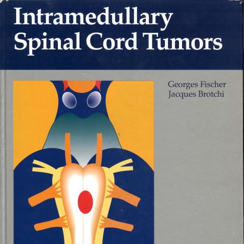 Intramedullary Spinal Cord Tumors