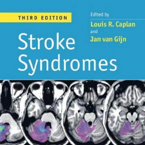 Stroke Syndromes