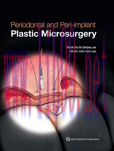 [AME]Periodontal and Peri-implant Plastic Microsurgery: Minimally Invasive Techniques with Maxi...