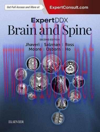 [AME]ExpertDDx: Brain and Spine, 2nd Edition (ORIGINAL PDF from_ Publisher)