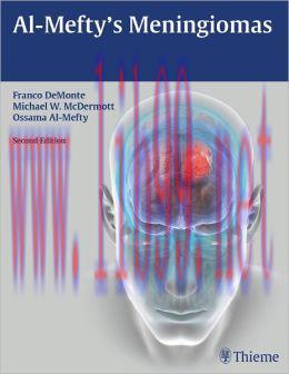 [AME]Al-Mefty's Meningiomas, 2nd Edition (Original PDF)