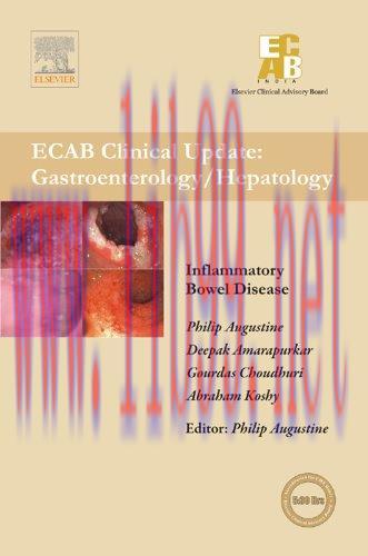 [AME]Inflammatory Bowel Diseases - ECAB (Original PDF)