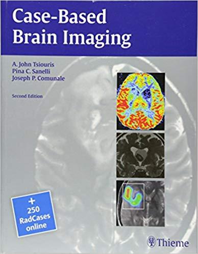 Case-Based Brain Imaging, 2nd Edition, 2013