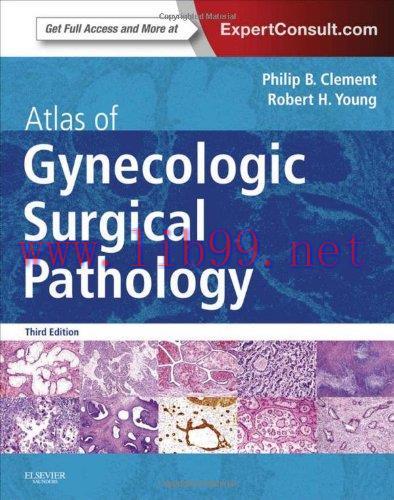 [AME]Atlas of Gynecologic Surgical Pathology, 3e (Original PDF)