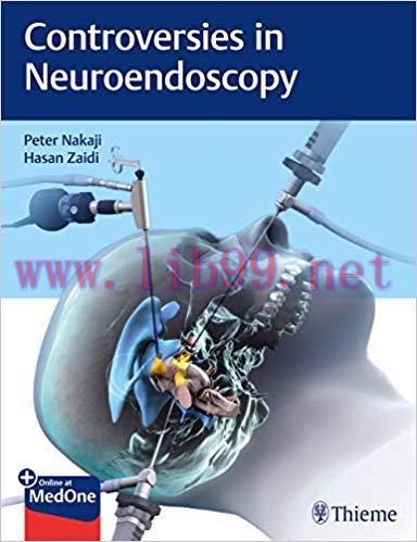 [PDF]Controversies in Neuroendoscopy