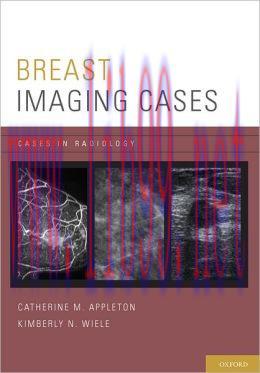 [AME]Breast Imaging Cases (Cases in Radiology)