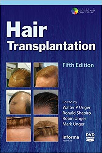 Hair Transplantation 5th Edition