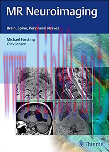 [PDF]MR Neuroimaging - Brain, Spine, Peripheral Nerves