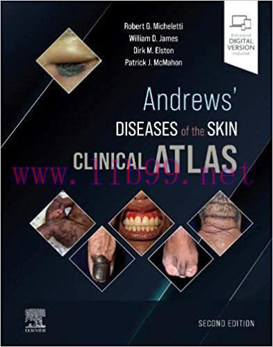 [PDF]Andrews&rsquo; Diseases of the Skin Clinical Atlas 2nd Edition