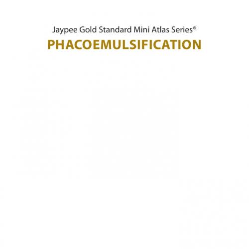 Phacoemulsification.9351527840