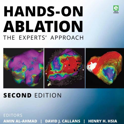 Hands-On Ablation The Experts'' Approach 2nd Edit