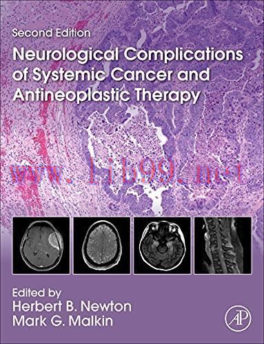 [AME]Neurological Complications of Systemic Cancer and Antineoplastic Therapy, 2nd Edition (Ori...