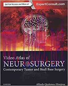 [PDF]Video Atlas of Neurosurgery: Contemporary Tumor and Skull Base Surgery 1st Edition