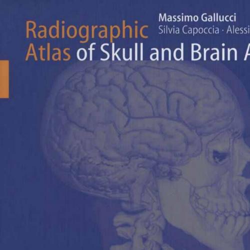Radiographic Atlas of Skull and Brain Anatomy
