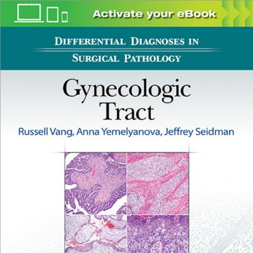 Differential Diagnoses in Surgical Pathology Gynecologic Tract - Original Pdf