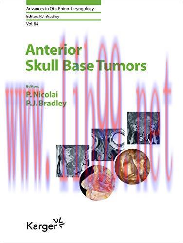 (PDF)Anterior Skull Base Tumors (Advances in Oto-Rhino-Laryngology)