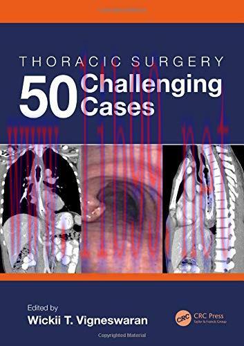 [AME]Thoracic Surgery: 50 Challenging cases (Original PDF)