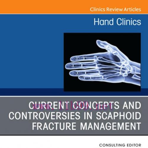 [PDF]Current Concepts and Controversies in Scaphoid Fracture Management