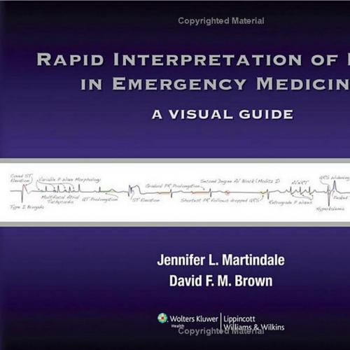 Rapid Interpretation of ECGs in Emergency Medicine A Visual Guide
